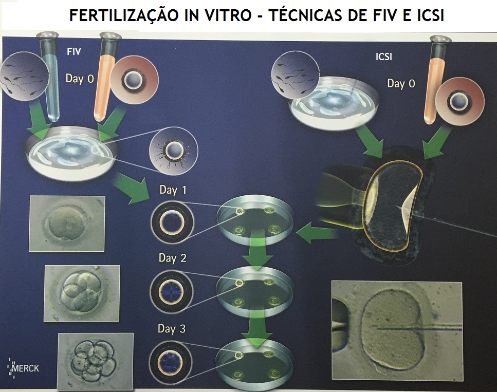 fertiliza__o_in_vitro.jpg