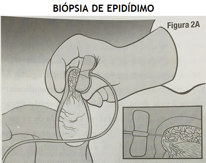 BI_PSIA_DE_EPID_DIMO.jpg