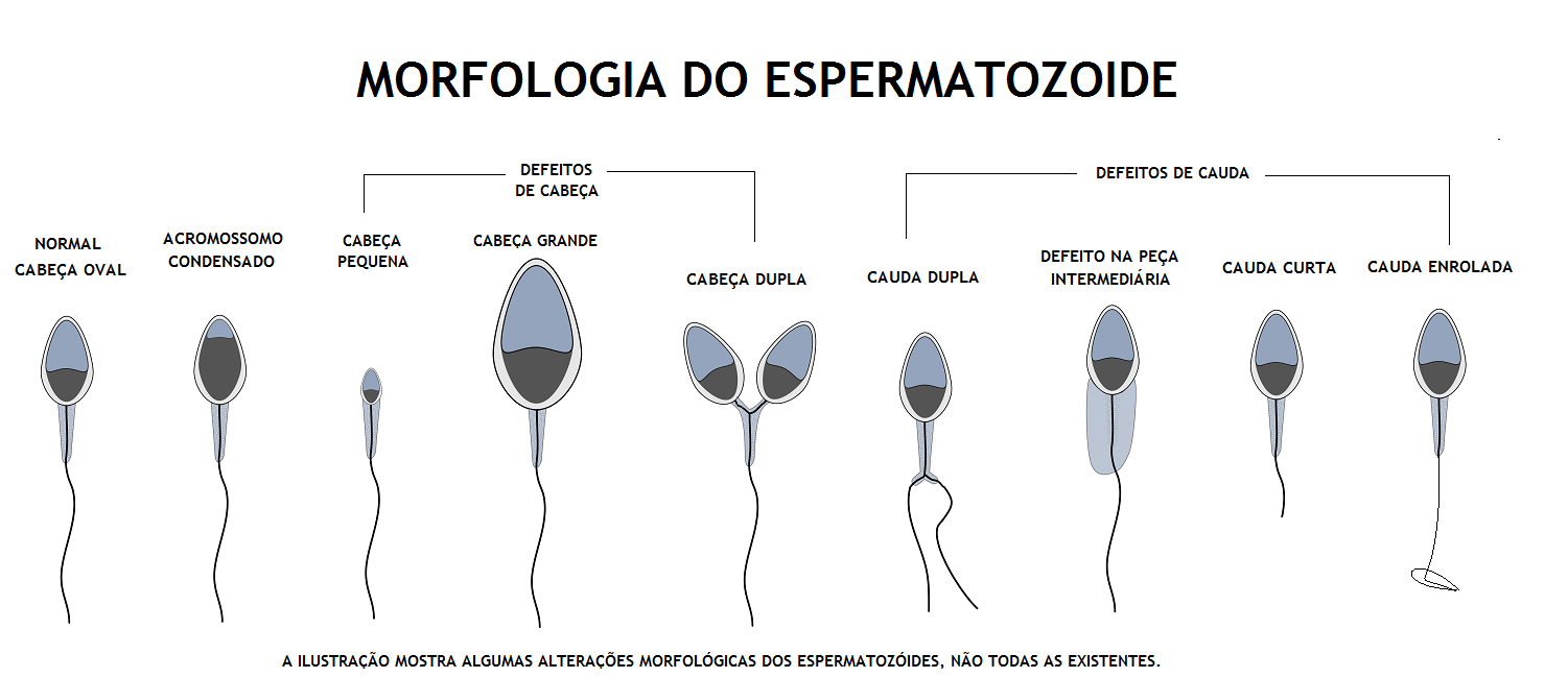 MORFOLOGIA_ESPERMATOZOIDE.png