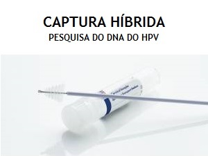CAPTURA_HIBRIDA_HPV.jpg