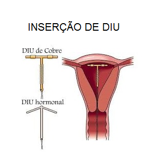 INSER__O_DE_DIU_CAPA.png